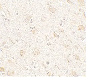 Anti-AMIGO1 antibody used in IHC (Paraffin sections) (IHC-P). GTX17210