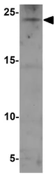 Anti-RHOG antibody used in Western Blot (WB). GTX17227
