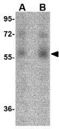 Anti-Orai1 antibody [3F6H5] used in Western Blot (WB). GTX17287