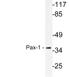Anti-PAX1 antibody used in Western Blot (WB). GTX17389
