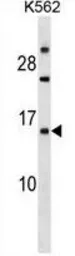 Anti-Emp1 antibody used in Western Blot (WB). GTX17488