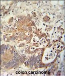 Anti-CHCHD2 antibody used in IHC (Paraffin sections) (IHC-P). GTX17498