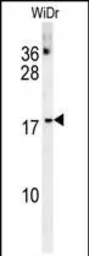Anti-CHCHD2 antibody used in Western Blot (WB). GTX17498