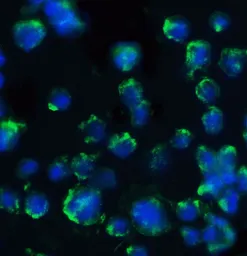 Anti-BACE1 antibody used in Immunocytochemistry/ Immunofluorescence (ICC/IF). GTX17545