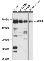 Anti-ADNP antibody used in Western Blot (WB). GTX17559