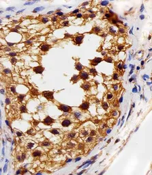 Anti-VEGF Receptor 3 antibody [818CT12.1.1] used in IHC (Paraffin sections) (IHC-P). GTX17567