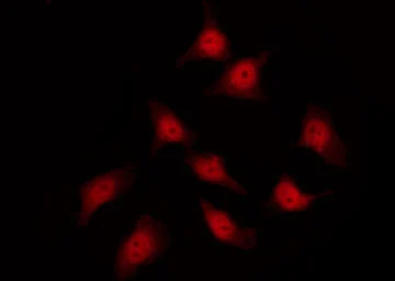 Anti-HSP27 (phospho Ser82) antibody used in Immunocytochemistry/ Immunofluorescence (ICC/IF). GTX17677