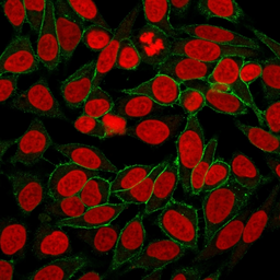 Anti-beta Catenin antibody [CTNNB1/2030R] used in Immunocytochemistry/ Immunofluorescence (ICC/IF). GTX17706