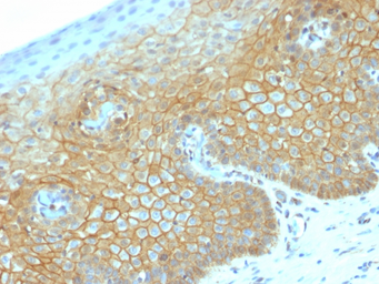 Anti-beta Catenin antibody [CTNNB1/2030R] used in IHC (Paraffin sections) (IHC-P). GTX17706