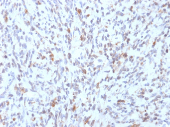 Anti-MyoD1 antibody [rMYD712] used in IHC (Paraffin sections) (IHC-P). GTX17751