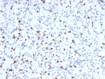 Anti-Myogenin antibody [MYOG/2660] used in IHC (Paraffin sections) (IHC-P). GTX17752