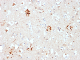 Anti-Ubiquitin antibody [UBB/2122] used in IHC (Paraffin sections) (IHC-P). GTX17824
