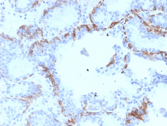 Anti-Cytokeratin 6 antibody [KRT6A/2368] used in IHC (Paraffin sections) (IHC-P). GTX17910