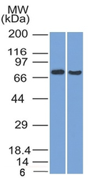 Anti-TCF4 antibody [TCF4/1705] used in Western Blot (WB). GTX17912