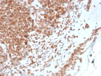 Anti-Emerin antibody [EMD/2168] used in IHC (Paraffin sections) (IHC-P). GTX17952