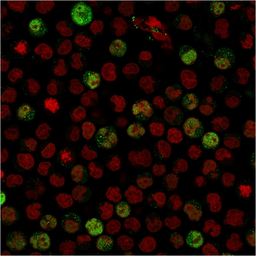 Anti-BOB1 antibody [BOB1/2424] used in Immunocytochemistry/ Immunofluorescence (ICC/IF). GTX17982