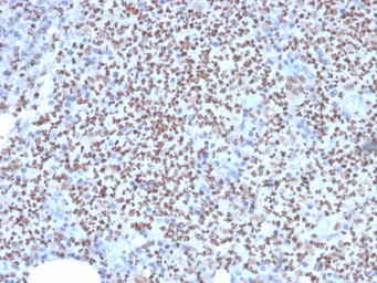 Anti-PU.1 antibody [PU1/2146] used in IHC (Paraffin sections) (IHC-P). GTX17997