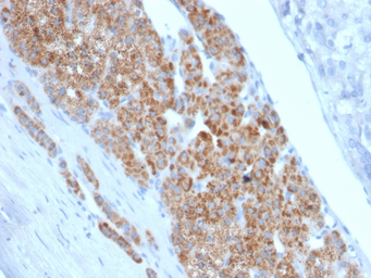 Anti-StAR antibody [STAR/2140] used in IHC (Paraffin sections) (IHC-P). GTX18017