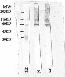 Anti-Presenilin 2 antibody used in Western Blot (WB). GTX18041