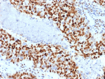 Anti-Cyclin E1 antibody [CCNE1/2460] used in IHC (Paraffin sections) (IHC-P). GTX18047