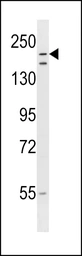 Anti-LTN1 antibody used in Western Blot (WB). GTX18154