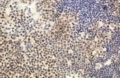 Anti-IL22 antibody used in IHC (Paraffin sections) (IHC-P). GTX18498