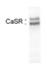 Anti-Calcium Sensing Receptor antibody [5C10, ADD] used in Western Blot (WB). GTX19347