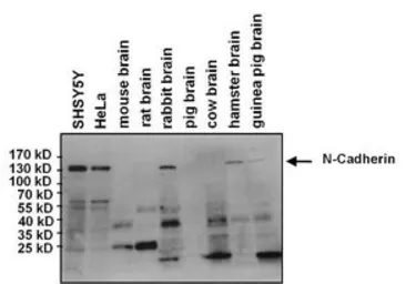 Anti-N-Cadherin antibody [8C11] used in Western Blot (WB). GTX19348
