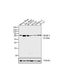 Anti-CRMP5 antibody [CR-1] used in Western Blot (WB). GTX19378