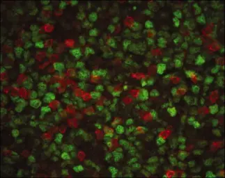 Anti-PCNA antibody [PC10] used in Immunocytochemistry/ Immunofluorescence (ICC/IF). GTX20029