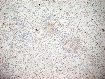 Anti-CD11b antibody [ICRF44] used in IHC (Frozen sections) (IHC-Fr). GTX20183
