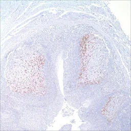 Anti-PD1 antibody [NAT105] used in IHC (Paraffin sections) (IHC-P). GTX20256