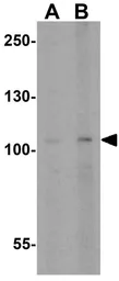 Anti-TLR3 antibody used in Western Blot (WB). GTX20260
