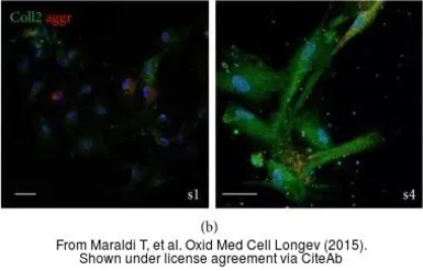 Anti-Collagen II antibody used in Immunocytochemistry/ Immunofluorescence (ICC/IF). GTX20300