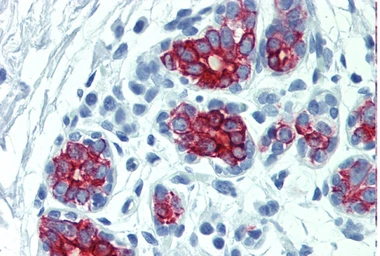 Anti-Cytokeratin 7 + 17 antibody [C-46] used in IHC (Paraffin sections) (IHC-P). GTX20670