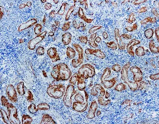 Anti-Calponin antibody [CALP (hCP)] used in IHC (Paraffin sections) (IHC-P). GTX20700