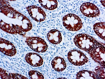 Anti-Cytokeratin 8 antibody [35βH11] used in IHC (Paraffin sections) (IHC-P). GTX20758