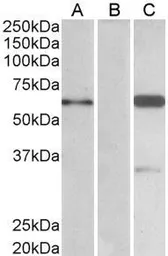 Anti-BAIAP2 (isoform 3) antibody used in Western Blot (WB). GTX20791