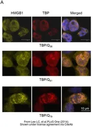 Anti-TBP antibody [1TBP18] used in Immunocytochemistry/ Immunofluorescence (ICC/IF). GTX20818