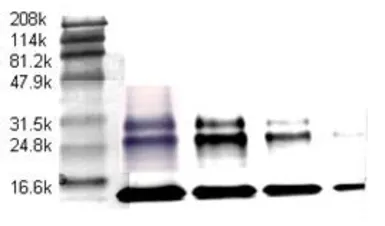 Anti-TGF beta antibody [TB21] used in Western Blot (WB). GTX21279