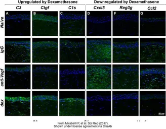 Anti-VEGFA antibody [VG1] used in IHC (Paraffin sections) (IHC-P). GTX21316