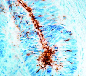 Anti-TAG72 antibody [B72-3] (ready-to-use) used in IHC (Paraffin sections) (IHC-P). GTX21320