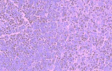 Anti-CCR5 antibody used in IHC (Paraffin sections) (IHC-P). GTX21673