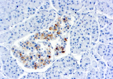 Anti-TIMP2 antibody [3A4] used in IHC (Paraffin sections) (IHC-P). GTX21828