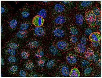 Anti-FYN antibody [FYN-01] used in Immunocytochemistry/ Immunofluorescence (ICC/IF). GTX21881