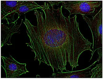 Anti-FYN antibody [FYN-01] used in Immunocytochemistry/ Immunofluorescence (ICC/IF). GTX21881
