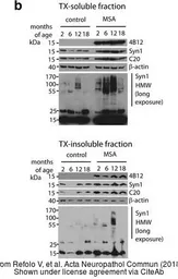 Anti-alpha Synuclein antibody [4B12] used in Western Blot (WB). GTX21904