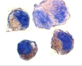 Anti-ADAM10 antibody used in Immunocytochemistry/ Immunofluorescence (ICC/IF). GTX21997