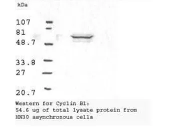 Anti-Cyclin B1 antibody used in Western Blot (WB). GTX22096