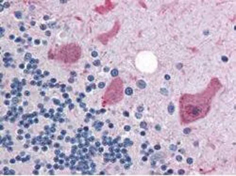 Anti-Cyclin B1 antibody used in IHC (Paraffin sections) (IHC-P). GTX22096